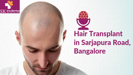 Hair Transplant in Sarjapura Road, Bangalore