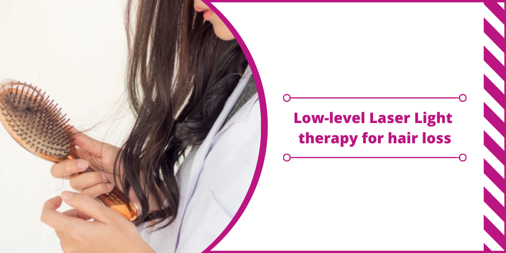 Low-Level Laser Therapy for Hair loss
