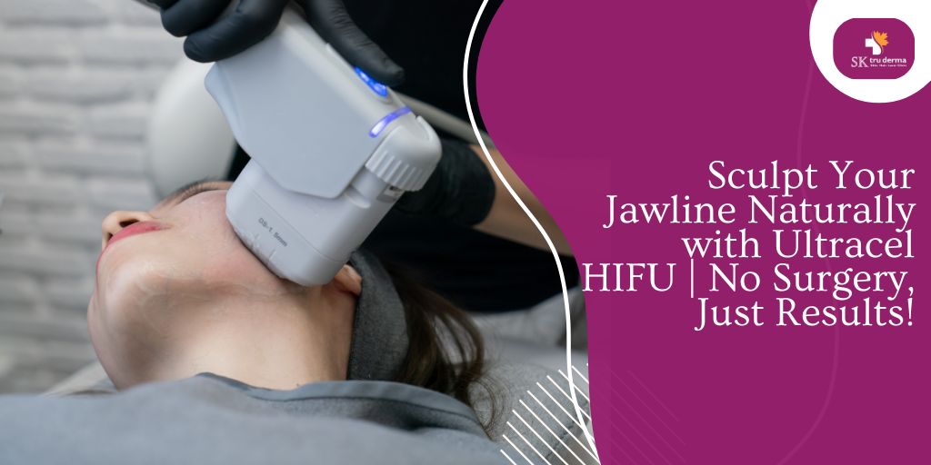 Sculpt Your Jawline Naturally with Ultracel HIFU | No Surgery, Just Results!