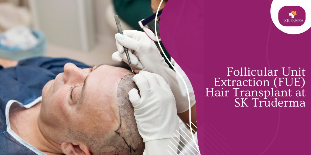 Hair Transplant Surgeon in Sarjapur Road | Dr. Kavitha GV Mandal