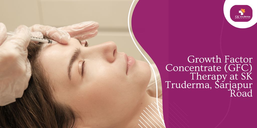 Growth Factor Concentrate (GFC) Therapy at SK Truderma, Sarjapur Road