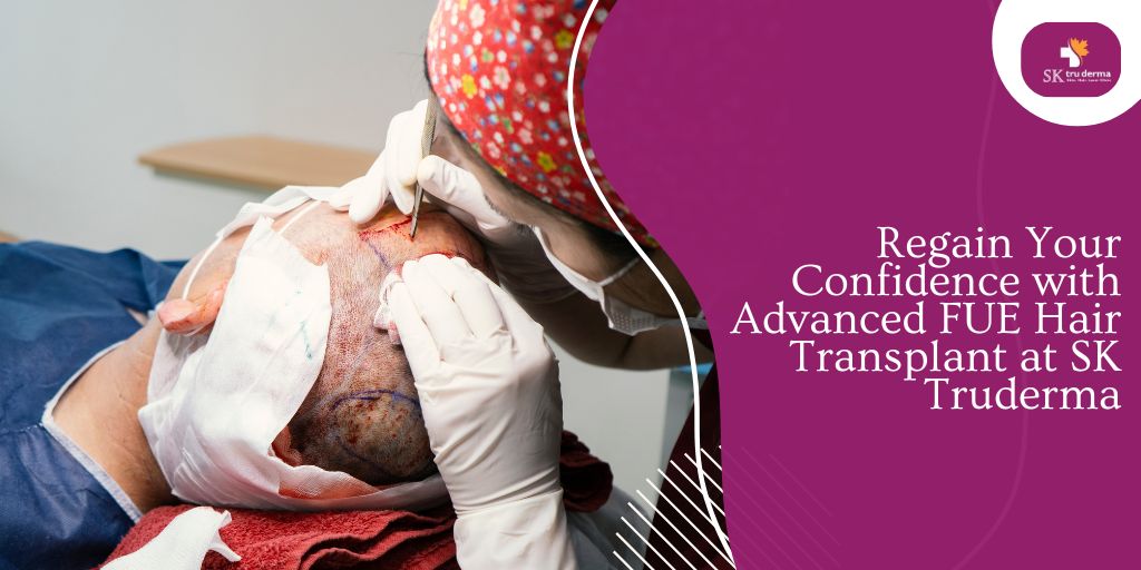 Regain Your Confidence with Advanced FUE Hair Transplant at SK Truderma