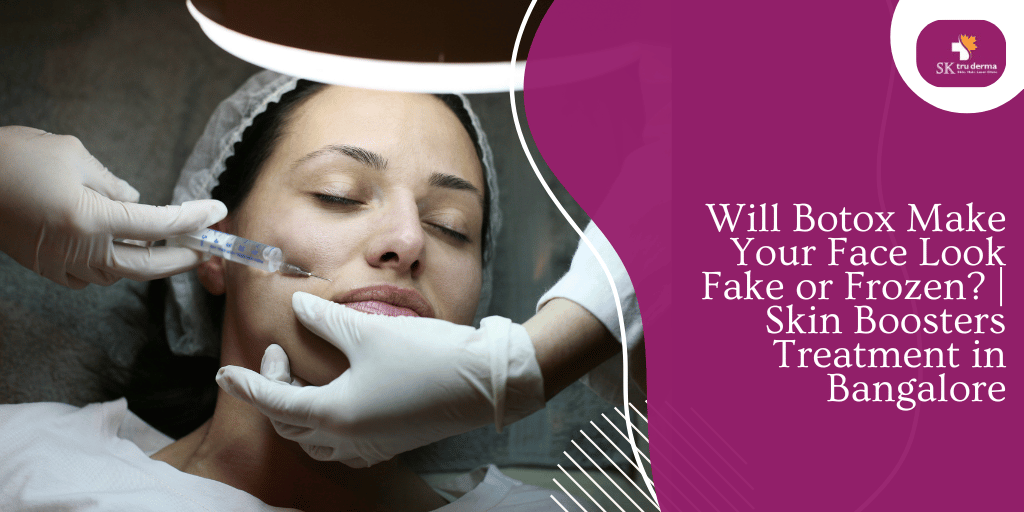 Will Botox Make Your Face Look Fake or Frozen? | Skin Boosters Treatment in Bangalore