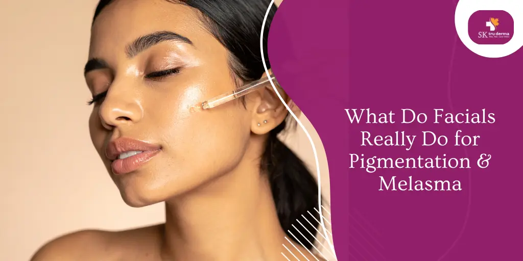 What Do Facials Really Do for Pigmentation & Melasma | Skin Pigmentation Treatment in Sarjapur Road