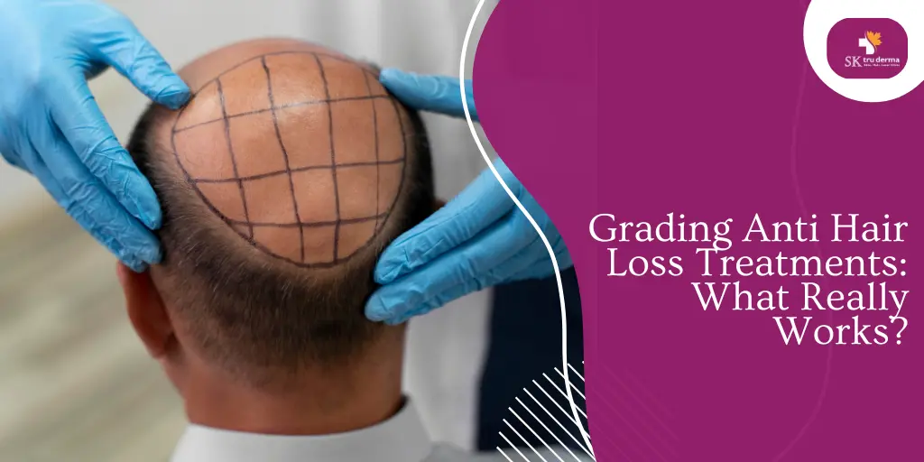Grading Anti Hair Loss Treatments: What Really Works? | Skin Clinics in Gunjur Road